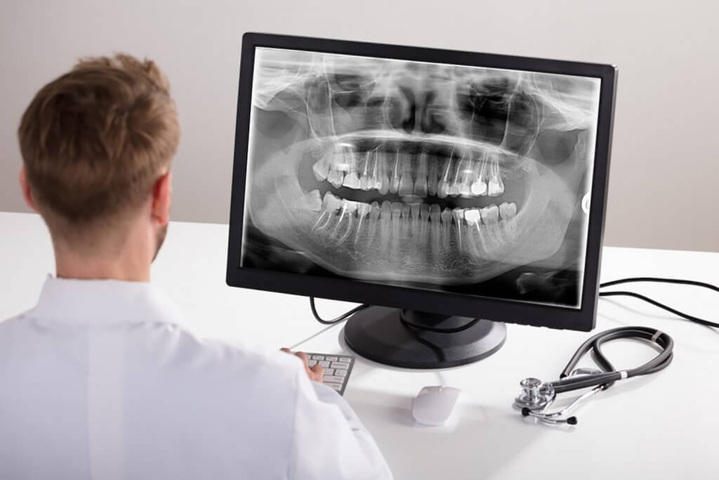 Aparatología digital para el tratamiento de Implantes dentales
